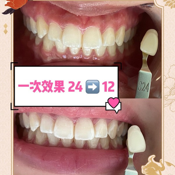 觀塘單次收費美容 美白牙齒 觀塘美容工作室 Salonfinder為您搜攞有質素的美容服務 Kwun Tong Facial